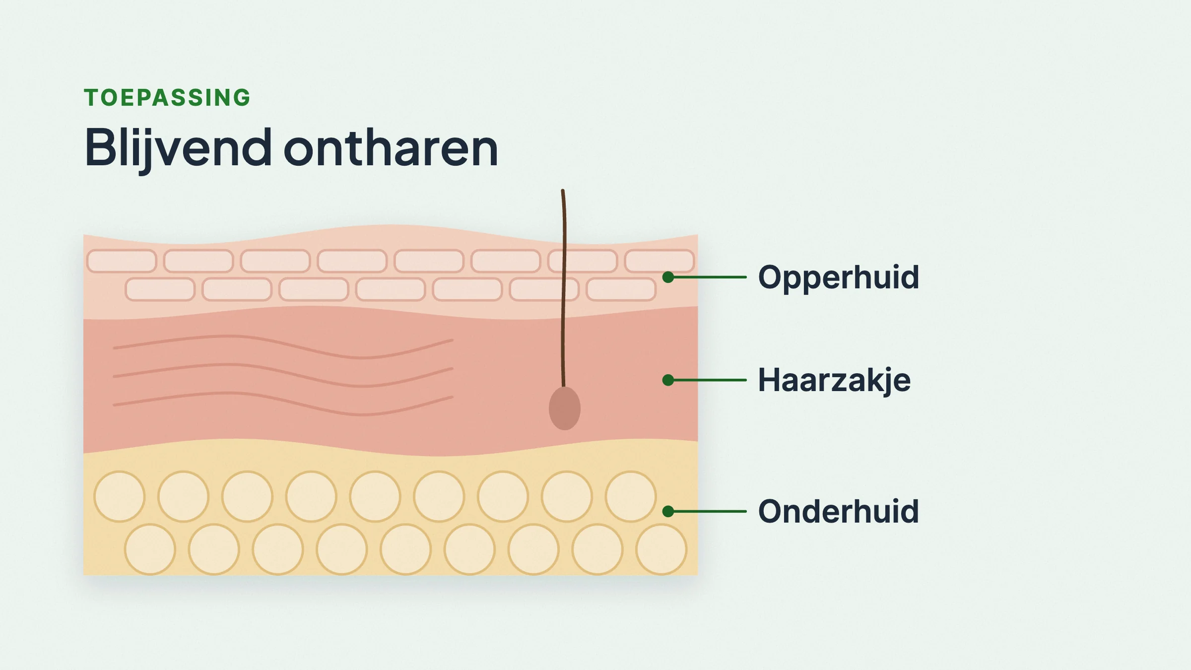 Getekende doorsnede van de huid in drie lagen met labels van boven naar beneden: opperhuid, haarzakje in de lederhuid en onderhuid.